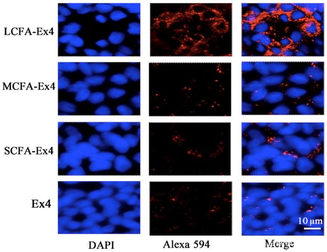 LCFA-Ex4 in Caco-2 cells was significantly higher than that in other groups.jpg